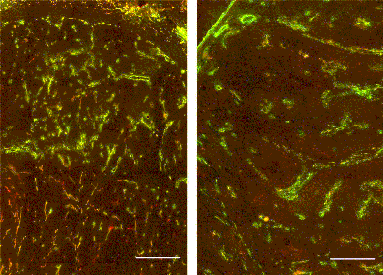 debagge-figures03-04