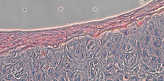 3DBiodruck_Epidermis.jpg