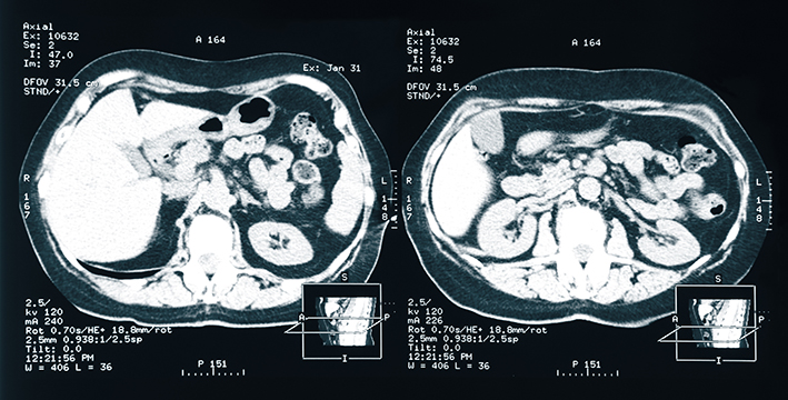 Kidney_Xray_Adobe_Andrey-Burmakin.jpg