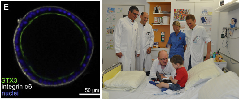 Bessere Diagnose und Prognosemöglichkeiten für PatientInnen mit angeborenen Durchfallerkrankung MVID. Prof. Lukas Huber,Dr. Andreas Entenmann, Prof. Thomas Müller, Dr. Simon Straub, Schwester Manuela Stern mit einem jungen Patienten. (v. li.) (Foto: MUI)