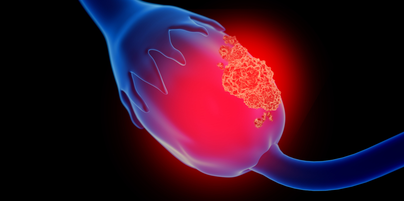 Erstmals wird eine Österreicherin Präsidentin der Europäischen Gesellschaft für gynäkologische Onkologie (ESGO)