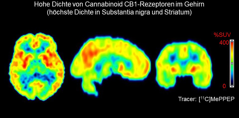 Erstmals nachgewiesen: zugelassenes Cannabinoid lindert Symptome bei Parkinson