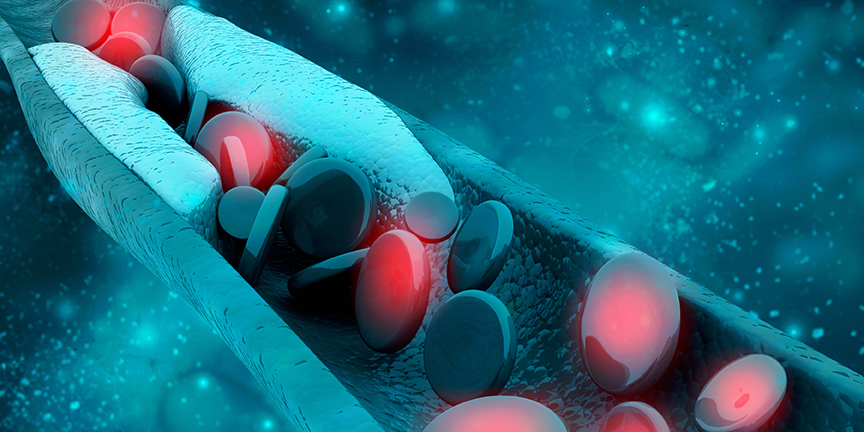 Weltweite Studie: Abwärtstrend bei Cholesterinspiegel in den westlichen Industrieländern