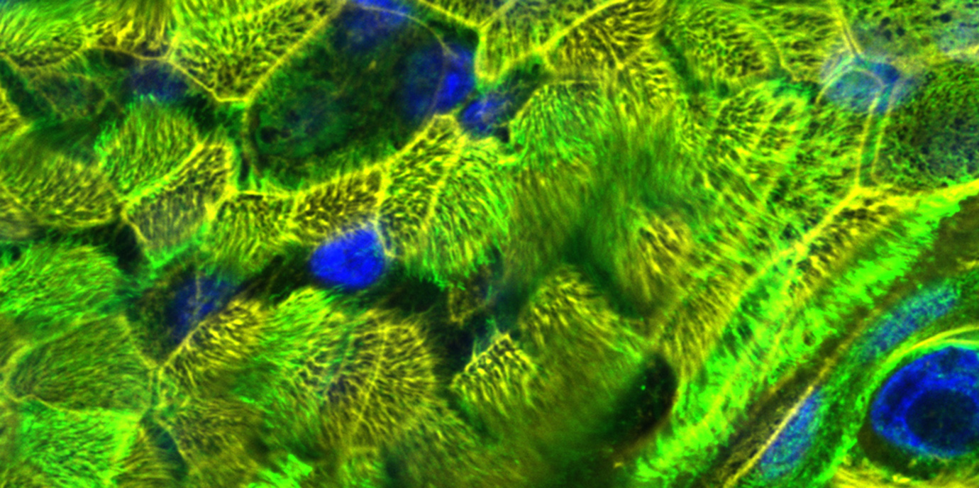 SARS-CoV-2 und das Immunsystem: Wie sich COVID-19 in der 3D-Zellkultur simulieren lässt