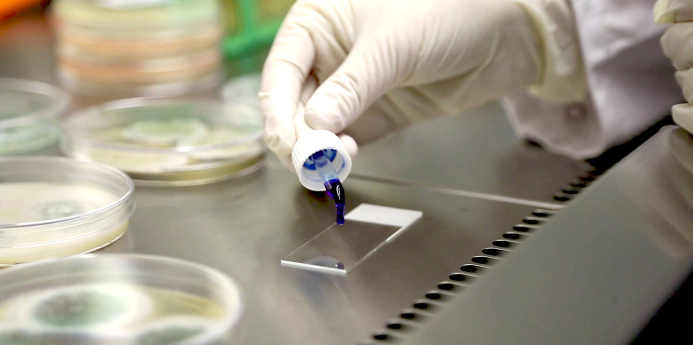 imSAVAR – Innovative Initiative zur verbesserten Toxizitätsprüfung von Immuntherapeutika