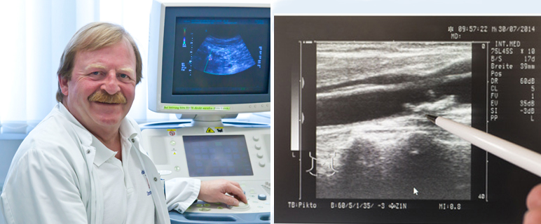 Neue Erkenntnisse zur Behandlung bei Carotisstenosen