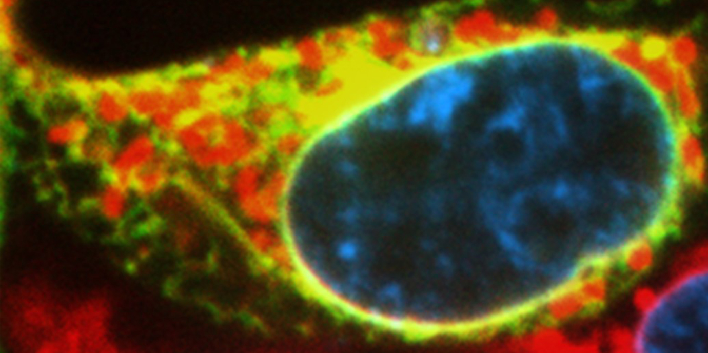 Lang gesuchtes Fettstoffwechsel-Gen zugeordnet