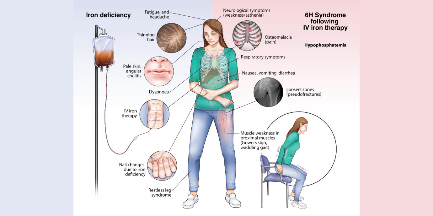 hypophosphataemie.jpg