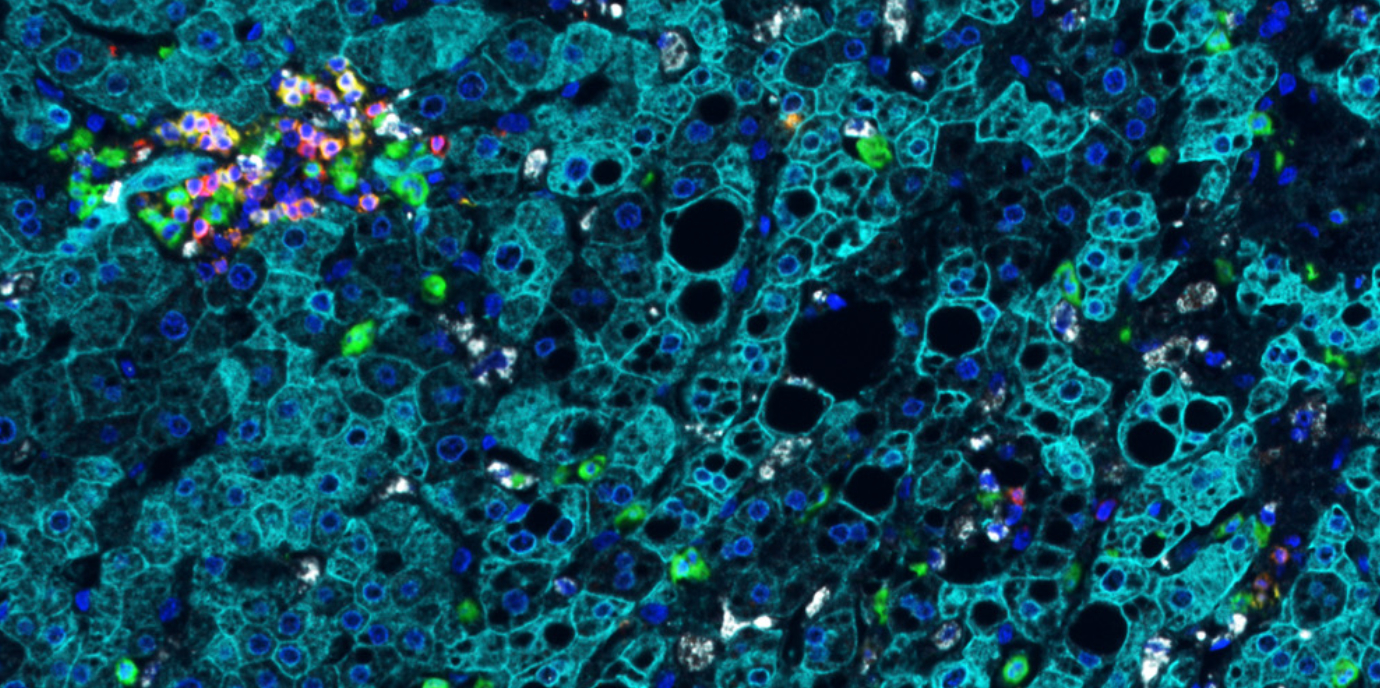 Immunzellen der Leber: Schneller und reichhaltiger, als gedacht