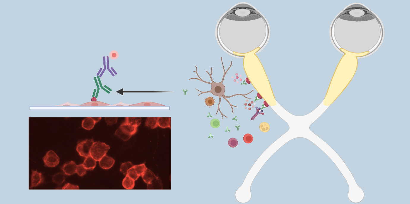 Diagnosekriterien für seltene neurologische Autoimmunerkrankung MOGAD definiert