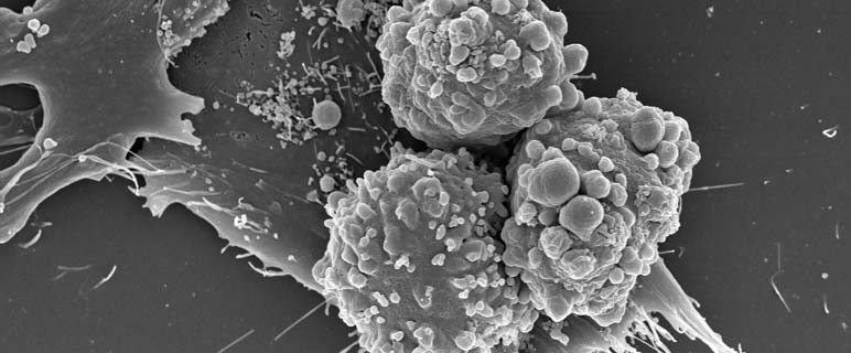 Myelomzellen Urheber: K. Pfaller - Histologie und Embryologie Innsbruck sowie W. Wunderlich und B. Huber