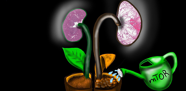 Nature: Forschungsteams beschreiben Ursache seltener Erkrankung