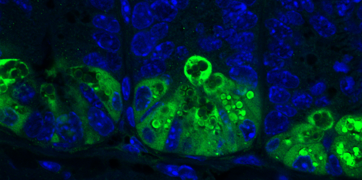 Mehrfach ungesättigte Fettsäuren und ihre Wirkung auf chronisch entzündliche Darmerkrankungen