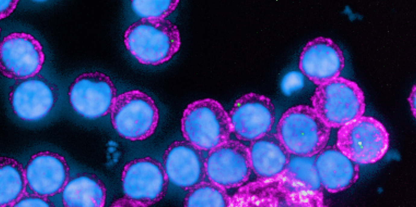 Immunantwort nach COVID-19: Antikörper bleiben auch bei Älteren lern- und abwehrfähig
