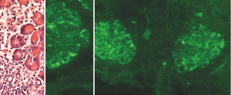 Bim und Bmf: Im Kollektiv gegen Autoimmunität und Tumoren