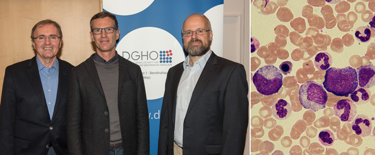 Neuer  Biomarker als innovatives Instrument für die Präzisionstherapie bei Leukämie