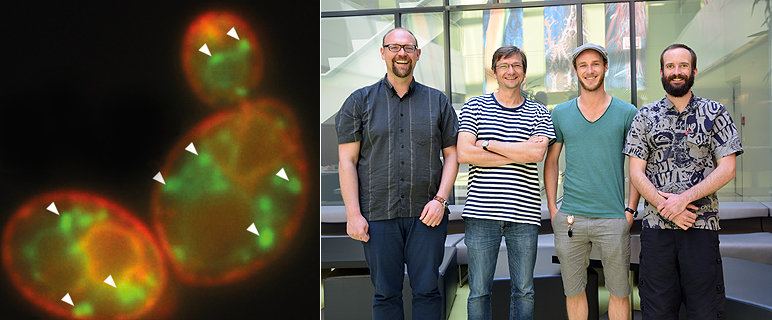 Zelluläre Müllentsorgung: Innsbrucker Zellbiologen entdecken neuen Protein-Abbau-Weg mit unerwarteter Funktion