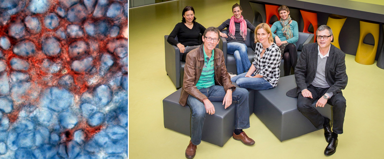 Lichtblick bei spezieller Leukämieform: Neue Behandlungswege mit erprobtem Medikament