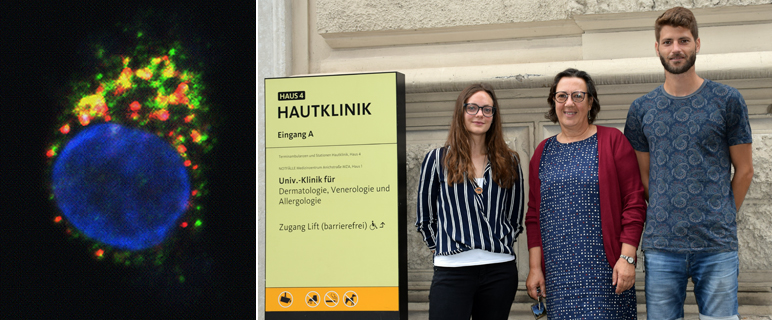 Neuer Mechanismus für die Entstehung allergischer Immunreaktionen identifiziert