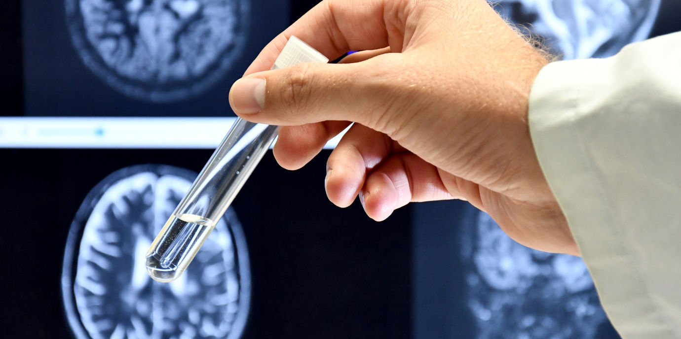 Kombination zweier neuer Biomarker optimiert Prognose und Therapie von MS