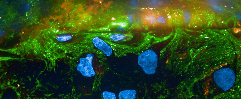 NIH unterstützt Innsbrucker HIV-Forschung