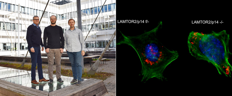 Ordnung in der Zelle: Wie Endosomen bei Bedarf richtig positioniert werden
