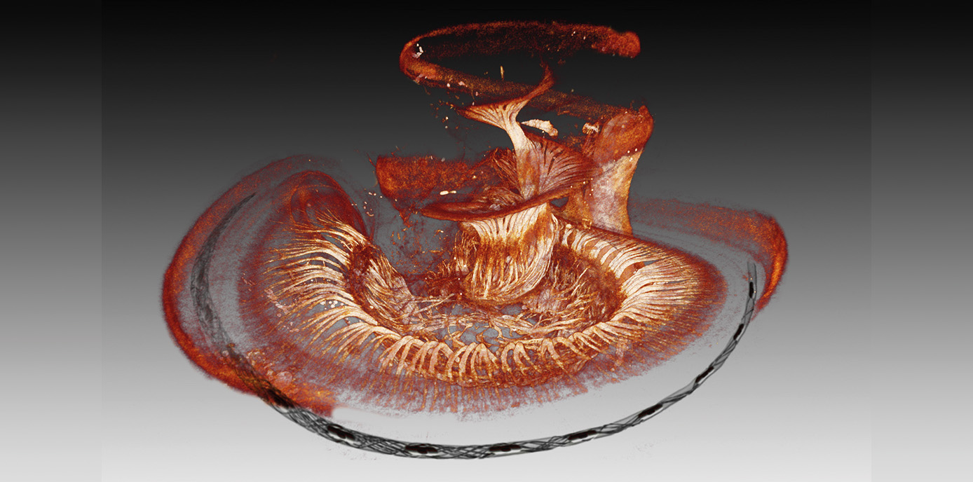 Neuer Antrieb für die nächste Generation von Cochlea-Implantaten