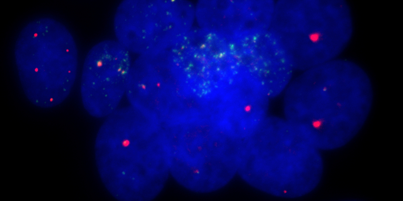 Leben oder Tod einer Zelle