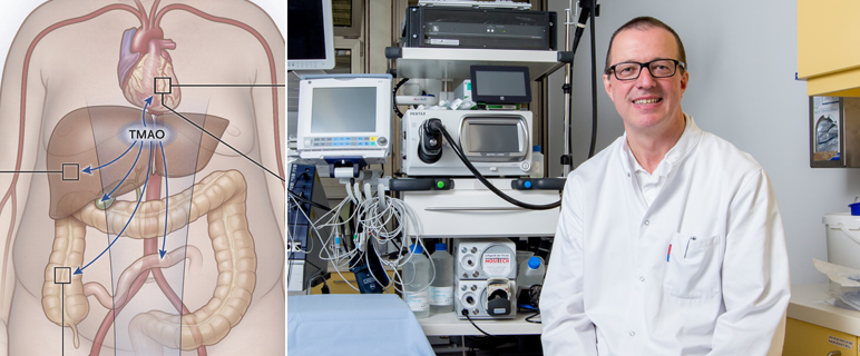 Nicht nur ein „Bauchgefühl“, der Zusammenhang zwischen Mikrobiota und Thrombosen