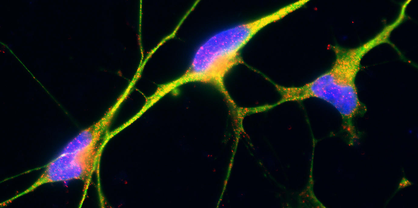 Neues Datenanalysetool für die Erforschung von chronischem Schmerz
