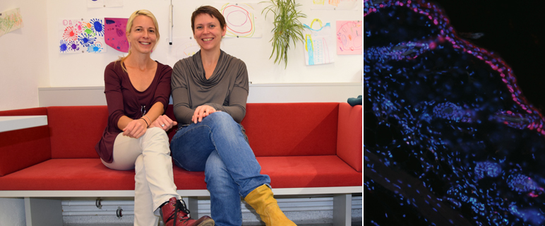 Langerhanszellen und ihre Rolle in der Immunüberwachung der Haut