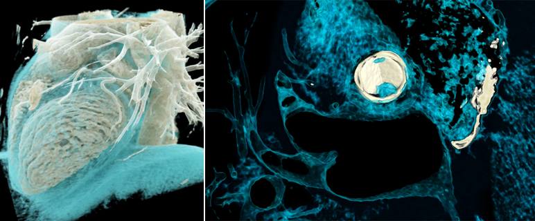 „Ausgezeichneter“ Sommer für das Cardio-CT Team 