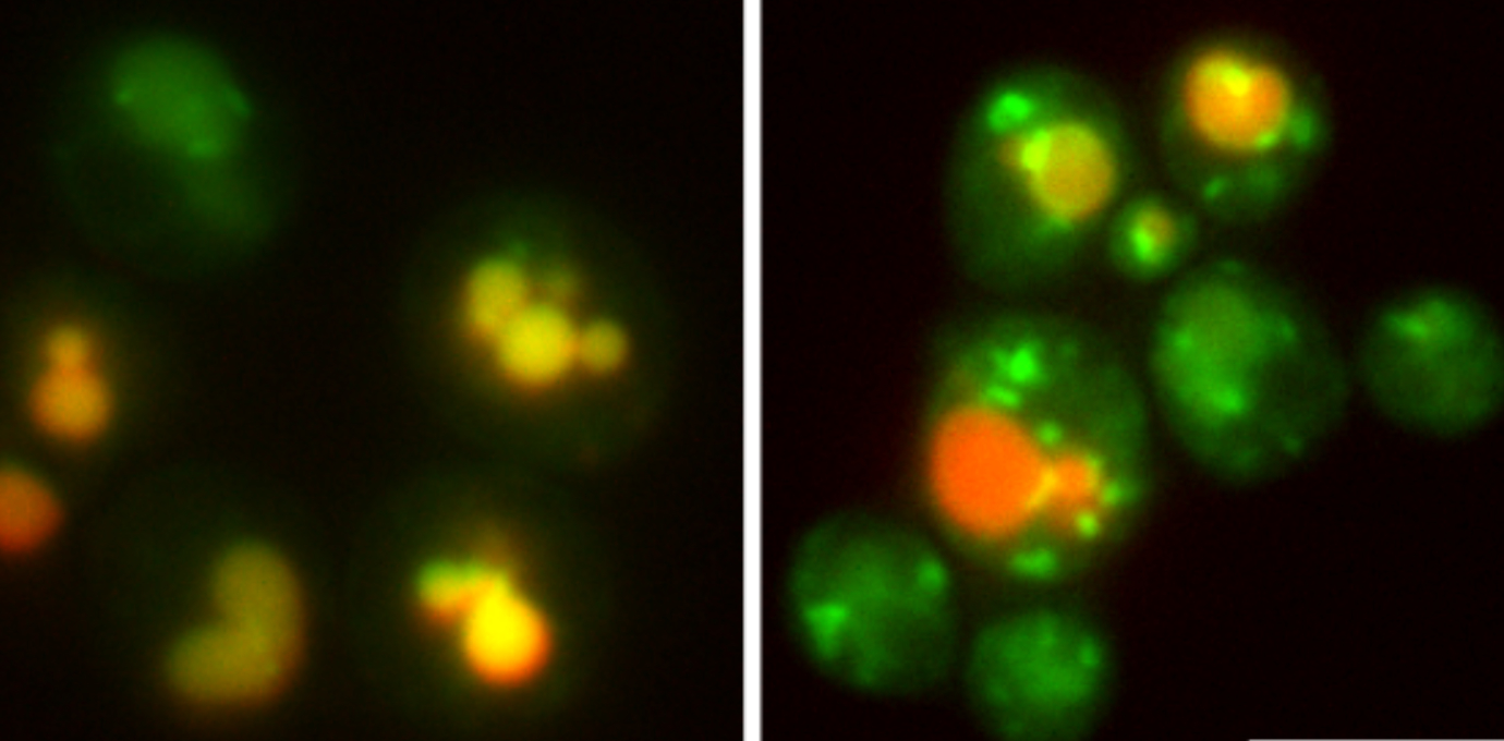 Neu: Golgi-Apparat checkt Membranproteine