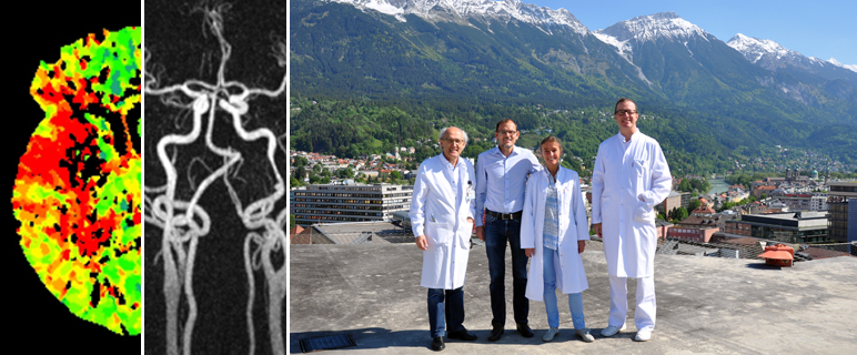 K-Projekt VASCage nimmt Arteriosklerose ins Visier