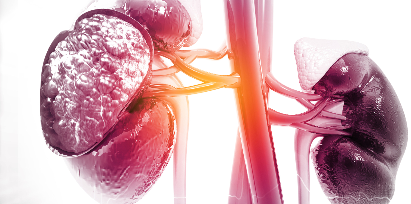 Translationale RNA Forschung bringt neue Erkenntnisse zur verbesserten Diagnostik bei chronischen Nierenerkrankungen