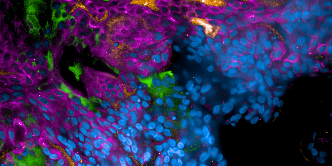 COVID-19: Humanes 3D-Modell enthüllt neues Angriffsziel zur Verhinderung schwerer Verläufe