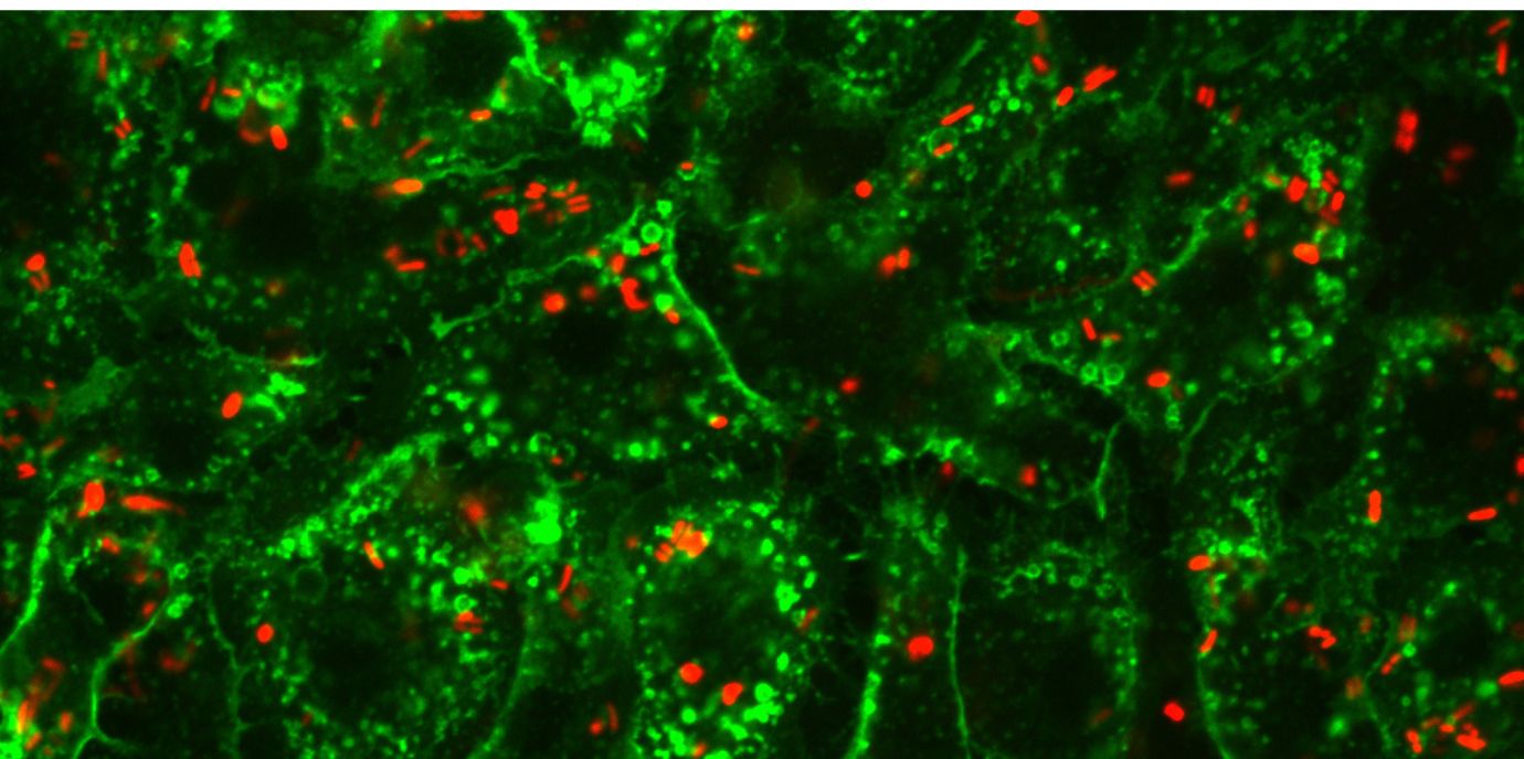Das Bild zeigt fluoreszente (rot) mit Salmonella Typhimurium infizierte Makrophagen, die aus Knochenmark differenziert wurden. (Foto: Martin Hermann) salmonellen.jpg