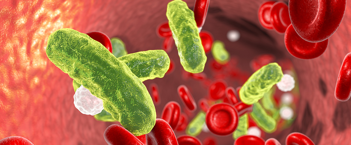 Sepsis: Früherkennung rettet Leben