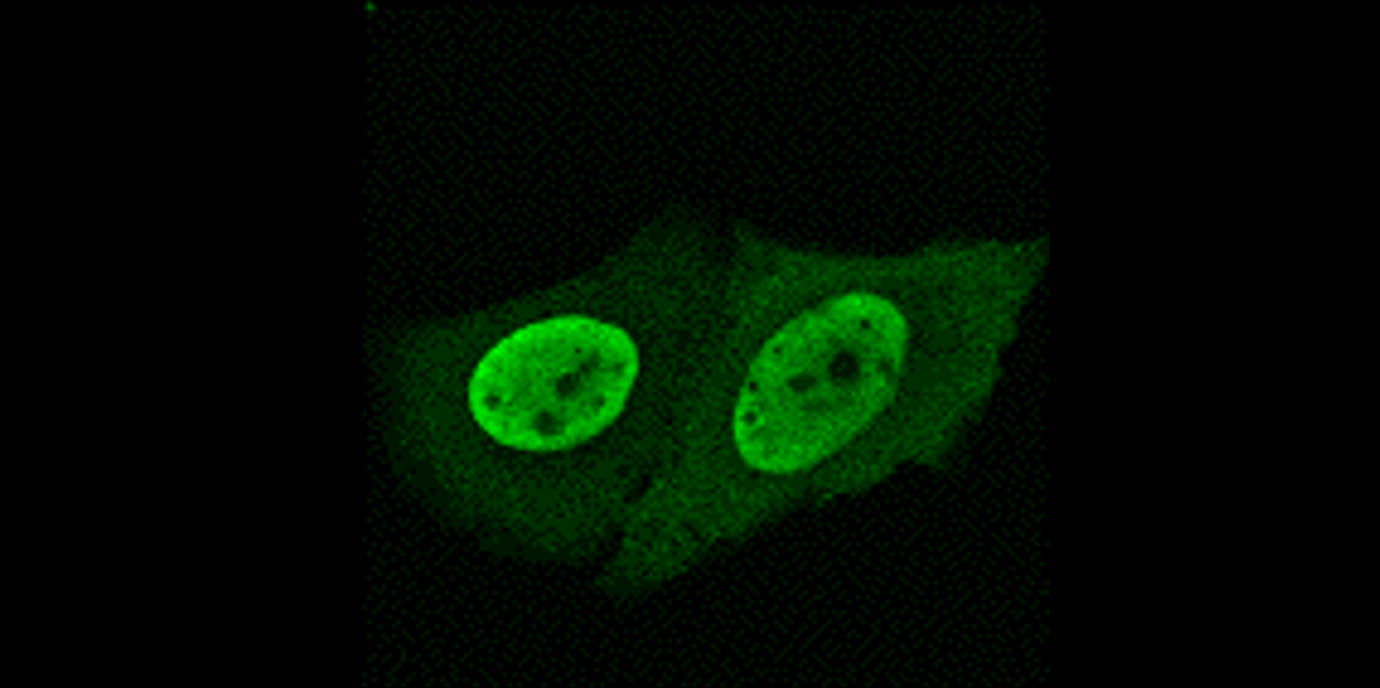 tyrosinphosphorylierung.jpg