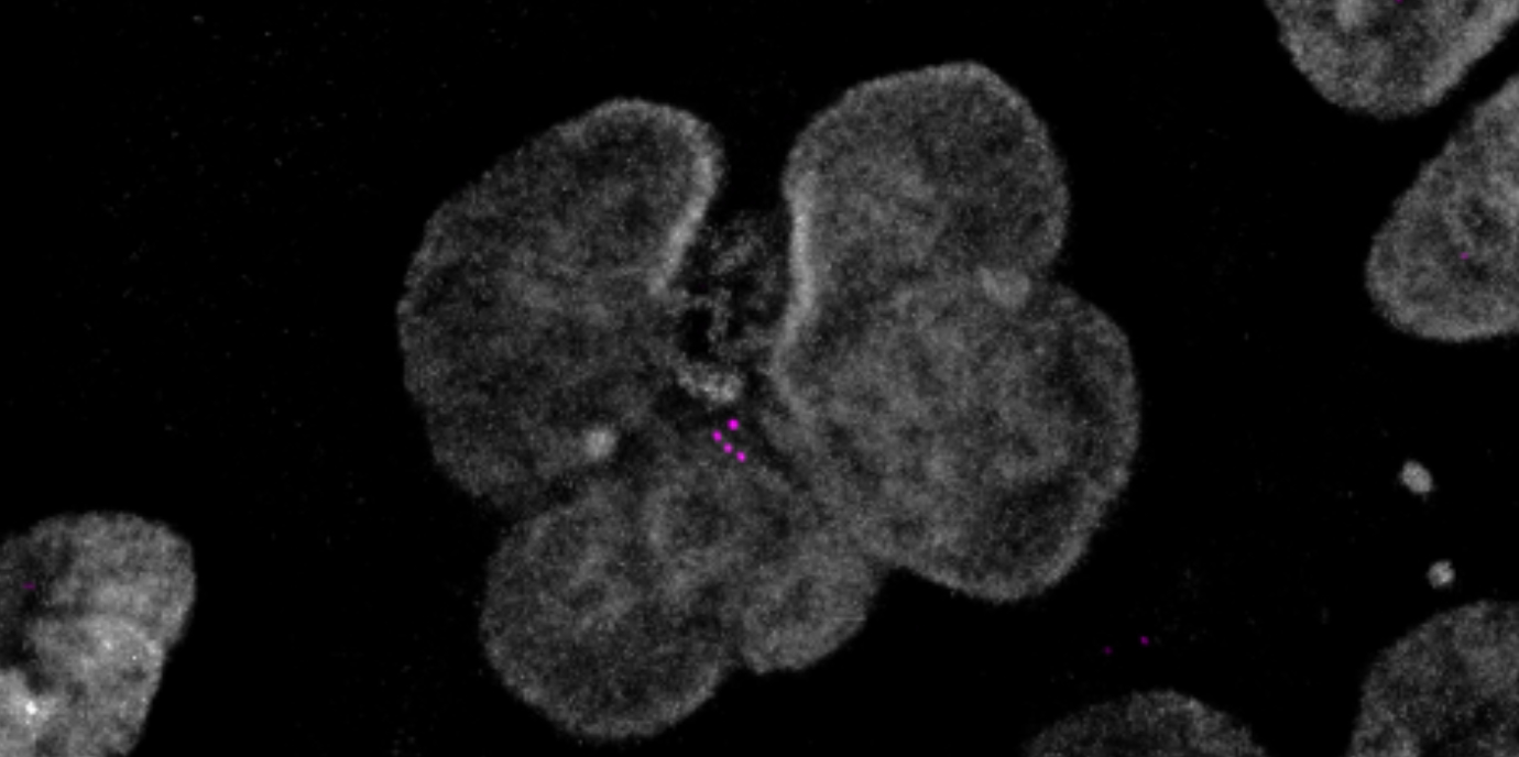 Überzahl an Zentrosomen löst Entzündung aus